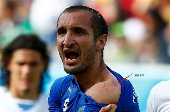  苏亚雷斯伤愈复出首战，乌拉圭锋霸锋芒再现